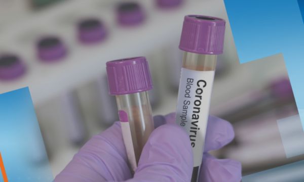 23-годишен немец даде положителен тест за коронавирус
