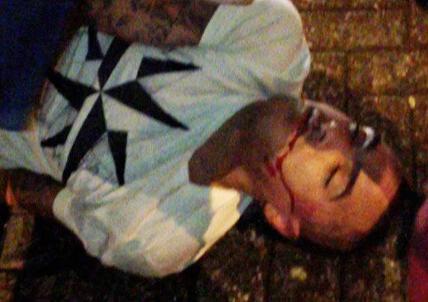  Защитникът на Нюкасъл Дани Симпсън, който беше пребит на улицата в 4:00 през нощта