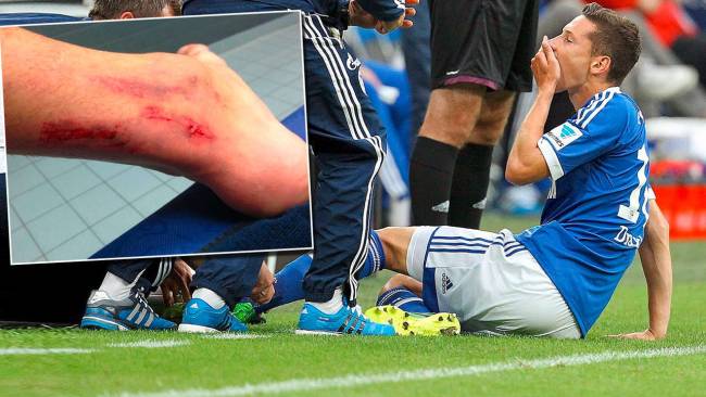 Дракслер с контузия, отпадна за мача с Парагвай