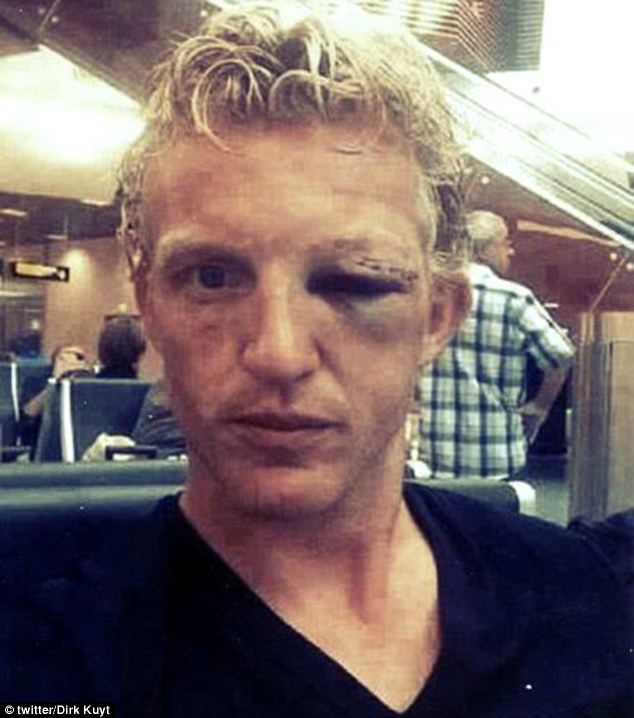 Дирк Каут получи сериозна травма на окото по време на тренировка с националния отбор 