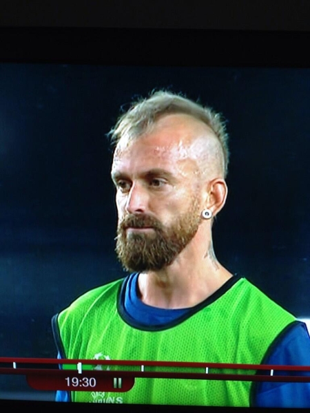 Мейрелеш с доста странна прическа срещу Арсенал