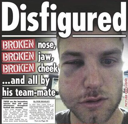 Порт Вейл уволни защитник, който нанесе следните щети на капитана си по време на тренировка