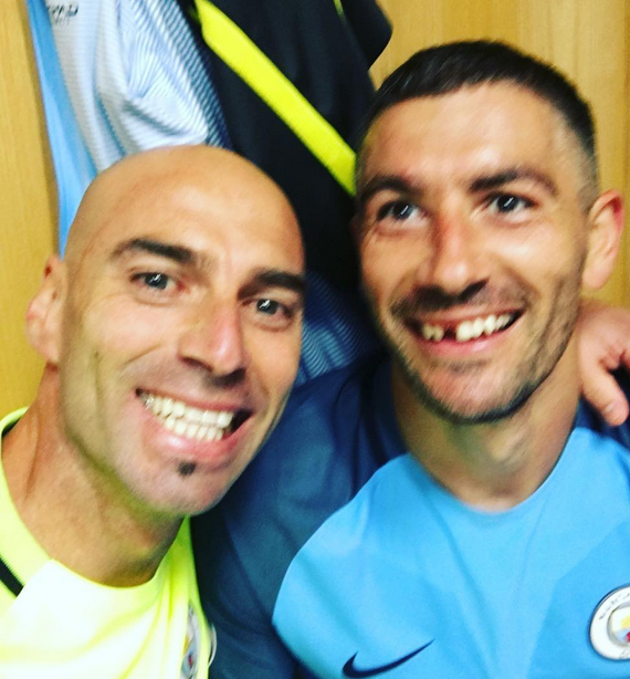 Коларов остана без зъб след сблъсък с Фелайни във вчерашното дерби. 