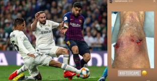 Варан ще може да играе с Барселона