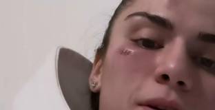 Чеченска боксьорка бе бита за втори път през последните шест месеца