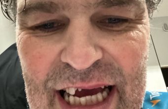 Чешкият хокеист Яромир Ягр за избите си четири зъба: „Бог винаги ще намери начин да се увери, че няма да напълнея“.