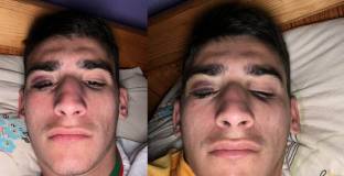   Пребиха футболист на Черно море в дискотека 