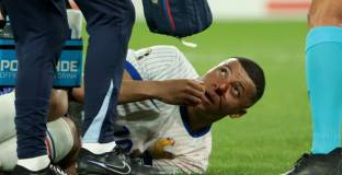 Мбапе счупи нос