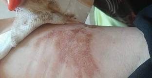 Битата от левскари жена: Душиха и ме биха пред сина ми!