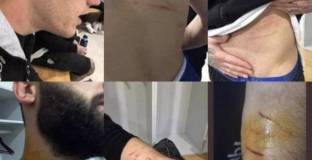 Футболист нарани с бръснач няколко съперника