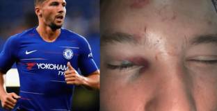 Пребиха Дринкуотър след инцидент в нощен клуб