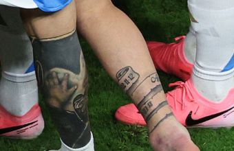 Травмата на Лео.