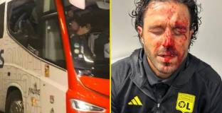 Фабио Гросо: Всяка сутрин гледах лицето си и виждах раните