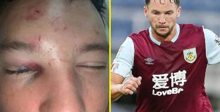 Дринкуотър ще пропусне две седмици