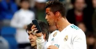 Роналдо: Всичко е добре, продължавам да съм красив 