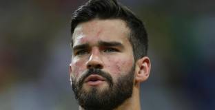 Миноле обясни лошата форма на Алисон