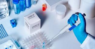 В Ювентус има случай на коронавирус