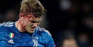 Олимпик Лион - Ювентус 1:0 