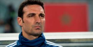 Треньорът на Аржентина показа последствията от сблъсъка