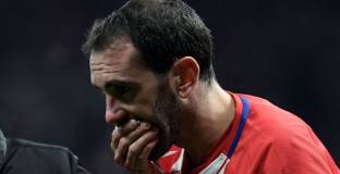 Годин се пошегува със загубата на зъбите си 