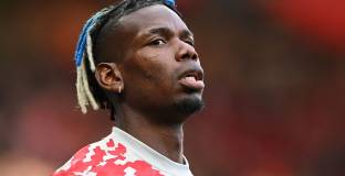 Погба: Надявам се, че травмата не е толкова зле