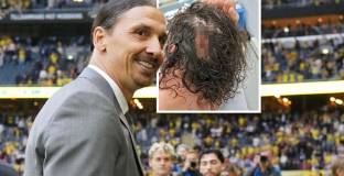 Ибрахимович е с травма на главата 